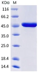 SARS-CoV-2 (COVID-19) Nucleocapsid protein, B.1.1.529 / Omicron variant, His tag. GTX03400-pro